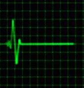 Image result for Heart Rate Monitor Graph