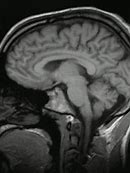 Image result for Brain Background GIF