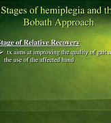 Image result for Bobath Stages of Stroke Recovery