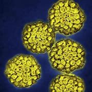 Image result for Human Papillomavirus Infection Bumps