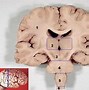 Image result for What Does a Brain Look Like