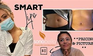 Image result for Sona Bella Stomach Results Images
