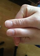 Image result for People with No Knuckles