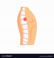 Image result for Spinal Injury Cartoon