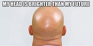 Image result for Ohio Bald Memes