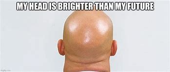 Image result for Bald Head Funny Meme
