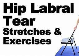 Image result for Hip Labral Tear Physical Therapy Exercises