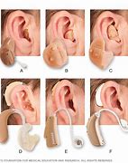 Image result for Open Ear Hearing Aids