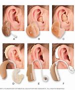 Image result for Best High Quality Hearing Aids
