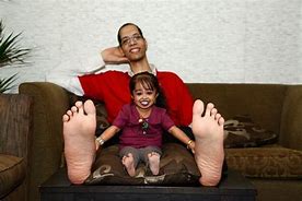 Image result for World's Smallest Feet
