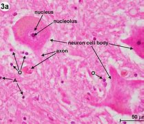 Image result for Spinal Cord Vertebrae Diagram