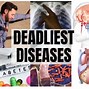 Image result for Dangerous Diseases