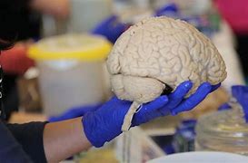 Image result for How Much Is a Brain Stand