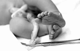 Image result for Hand Umbilical Cord