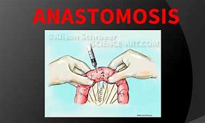 Image result for anastomizarse