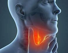 Image result for Women with Throat Cancer