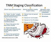Image result for Stomach Tumor Size Chart