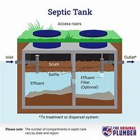 Image result for Septic Bed