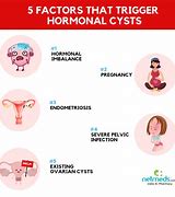 Image result for Big Ovarian Cyst Symptoms