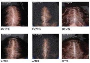 Image result for Graph Gradient Sample