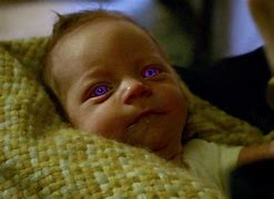 Image result for Babies with Purple Eyes