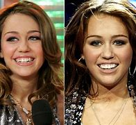Image result for Beyoncé Small Teeth
