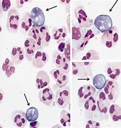 Image result for Naegleria Fowleri