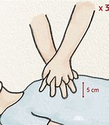 Image result for CPR Compressions Steps