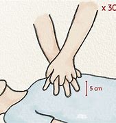 Image result for Compressions to Breath for CPR