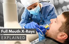 Image result for FMX X-ray