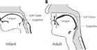 Image result for Child Vs. Adult Larynx