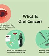 Image result for Jaw Pain Cancer
