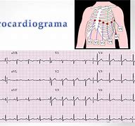 Image result for cardiogfama