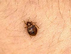 Image result for Scabies Bed Bugs
