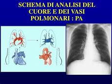 cuore e vasi ppt rx torace powerpoint presentation id 698666 cuore e vasi ppt rx torace powerpoint presentation id 698666