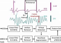 Image result for Ballistocardiogram