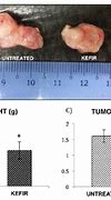 Image result for How Big Is a Centimeter Tumor