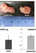 Image result for Tumor Sizes in mm