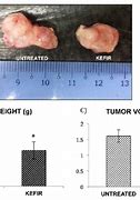 Image result for How Big Is 3 Cm for Tumor