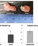 Image result for How Big Is 6 mm Tumor