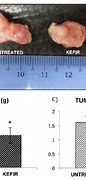 Image result for 6 mm Size of Tumor