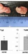 Image result for How Big Is 9Mm Tumor