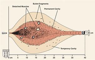 Image result for 9Mm Wound Profile