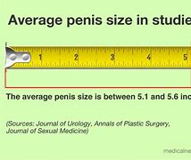 Image result for How Big Is 20 Cm in Inches