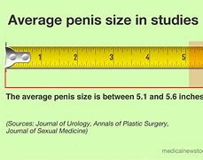 Image result for How Big Is 7 Cm in Inches