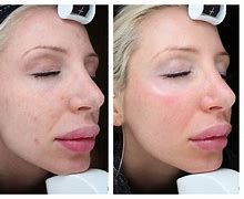 Image result for Dermatologist Facial Treatments