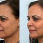 Image result for Sharp Jaw Woman