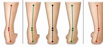 Image result for Neutral Foot Position