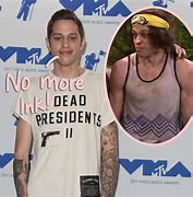 Image result for Pete Davidson Tattoo Removal Before and After