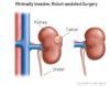 Image result for Kidney Tumor Size Chart